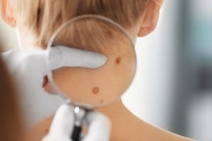 Skin dermatologist examining 