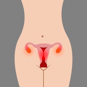 Illustration of the problems of the female reproductive system