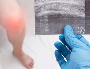 ultrasound of womans knee pain