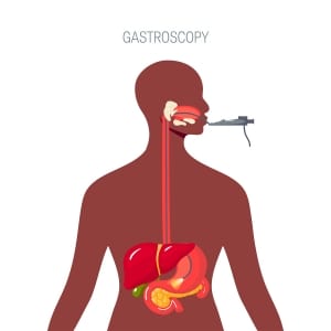 gastroscopy examination illustration