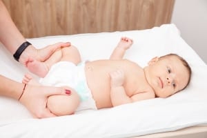 baby with hip joint problem