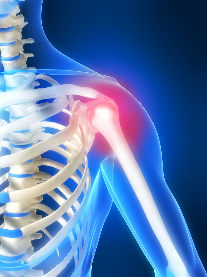 Shoulder Joint Replacement | Herzliya Medical Center | Treatment in Israel